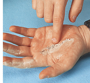 Skin-Friendly Adhesive Cleaner